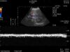 HITACHI C25P Ultrasound Transducer