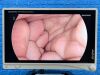 STRYKER 1588 Tower Laparoscope