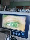 VERATHON Glidescope Laryngoscope