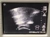 SONOSITE C60 Ultrasound Transducer