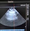 SONOSITE P21x Ultrasound Transducer
