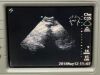 SONOSITE C15 Ultrasound Transducer