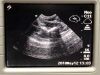 SONOSITE C11 Ultrasound Transducer