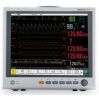 EDAN Elite V8 Multiparameter Monitor