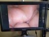 PANASONIC Storz 9826NB-3D-US with TM003 3D glasses PANASONIC EJ-MDA26