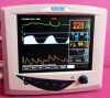 SURGIVET Veterinary Vital Signs Monitor Monitor