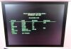 SURGIVET Veterinary Vital Signs Monitor Monitor