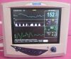 SURGIVET Veterinary Vital Signs Monitor Monitor