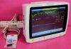 SURGIVET Veterinary Vital Signs Monitor Monitor