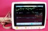 SURGIVET Veterinary Vital Signs Monitor Monitor
