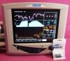 SURGIVET Veterinary Vital Signs Monitor Oximeter - Pulse