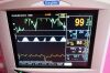 SURGIVET Veterinary Vital Signs Monitor Oximeter - Pulse
