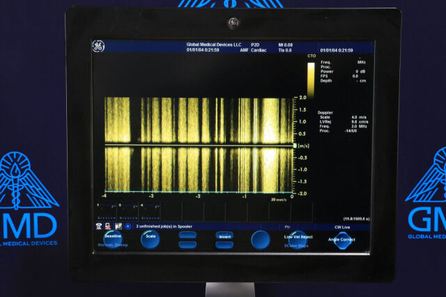 GE HEALTHCARE P2D-RS Ultrasound Transducer