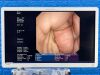 OLYMPUS GF-UE260 Endoscope