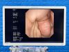 OLYMPUS GF-UE260 Endoscope