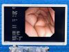 OLYMPUS GF-UE260 Endoscope
