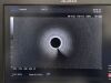 OLYMPUS GF-UE260 Endoscope