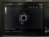 OLYMPUS GF-UE260 Endoscope