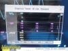 PHILIPS 2018  Intellivue MP5SC Spot Check Monitor