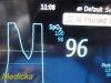 PHILIPS 2018  Intellivue MP5SC Spot Check Monitor