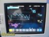 PHILIPS 2018  Intellivue MP5SC Spot Check Monitor