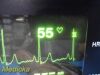 WELCH ALLYN Protocol 6200 Series Patient Monitor