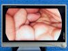 STRYKER 1488 HD Full Tower, YOM: 2016 Laparoscope