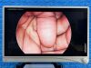 STRYKER 1488 HD Full Tower, YOM: 2016 Laparoscope