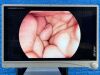 STRYKER 1488 HD Full Tower, YOM: 2016 Laparoscope