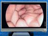 STRYKER 1488 Full HD Tower Laparoscope