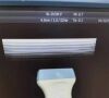 GE 9LD Ultrasound Transducer