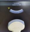GE C15D Ultrasound Transducer