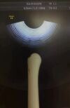 GE IC5-9-D Ultrasound Transducer