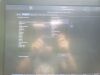 GE Vivid E95 Ultrasound Machine (DOM: 2015) w/ GE M5Sc-D Probe