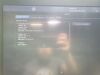 GE Vivid E95 Ultrasound Machine (DOM: 2015) w/ GE M5Sc-D Probe