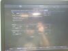 GE Vivid E95 Ultrasound Machine (DOM: 2015) w/ GE M5Sc-D Probe