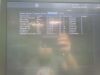 GE Vivid E95 Ultrasound Machine (DOM: 2015) w/ GE M5Sc-D Probe