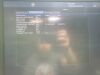 GE Vivid E95 Ultrasound Machine (DOM: 2015) w/ GE M5Sc-D Probe