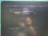 GE Vivid E95 Ultrasound Machine (DOM: 2015) w/ GE M5Sc-D Probe