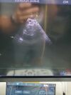 GE Vivid E95 Ultrasound Machine (DOM: 2015) w/ GE M5Sc-D Probe