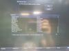 GE Vivid E95 Ultrasound Machine (DOM: 2015) w/ GE M5Sc-D Probe