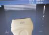 PHILIPS L12-3 Ultrasound Transducer