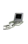 SONOSITE TITAN  Ultrasound Machine