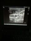 SONOSITE TITAN  Ultrasound Machine