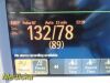 PHILIPS Intellivue MP30 (862135) Anesthesia Monitor