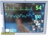 GE 2006  Dash 4000 (2X IBP SPO2 T/CO NBP CO2 EKG PRINT) Monitor
