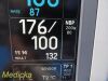 GE 2006  Dash 4000 (2X IBP SPO2 T/CO NBP CO2 EKG PRINT) Monitor
