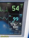 GE 2006  Dash 4000 (2X IBP SPO2 T/CO NBP CO2 EKG PRINT) Monitor