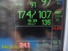 GE 2006  Dash 4000 (2X IBP SPO2 T/CO NBP CO2 EKG PRINT) Monitor