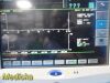 SPACELABS 91370 Ultraview SL,W/ Leads, 91496 Module & PSU ~ Patient Monitor